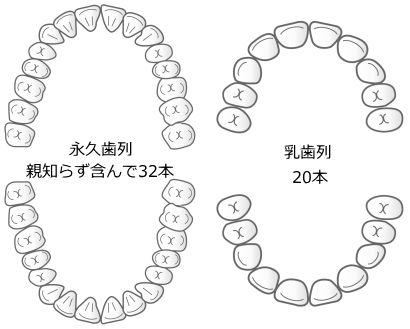 先天欠如歯 先天欠如歯
