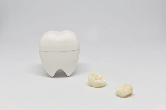 歯周病の最新治療 外科的療法　　タンパク塗り骨を再生