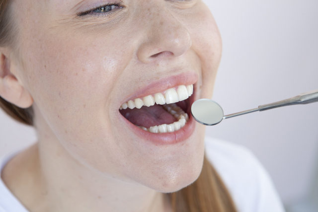 女性の口元・デンタルミラー 女性の口元・デンタルミラー