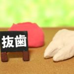 親知らずの抜歯～注意することはあるの？～