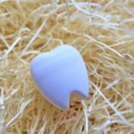 治療の跡が目立たない?!~ダイレクトボンディングってなに?~