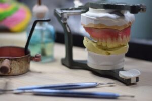 インプラント費用の全貌！～長期的価値を見極める投資判断～